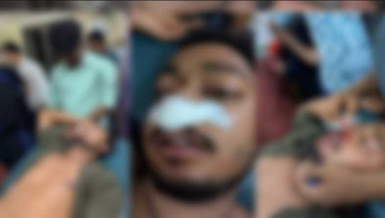 শাহরাস্তিতে আওয়ামীলীগের সংঘবদ্ধ হামলায় জুলাই যোদ্ধাসহ ৩ জন আহত