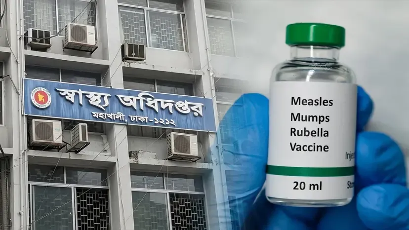 হামের উপসর্গে আরও ৫ জনের মৃত্যু, আক্রান্ত ১১৮০
